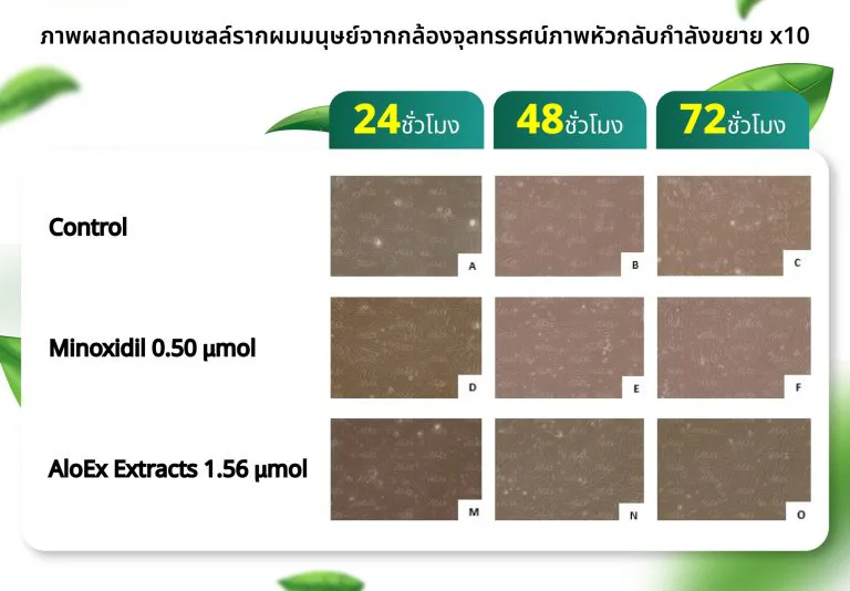 Photo of follicle-cell test results