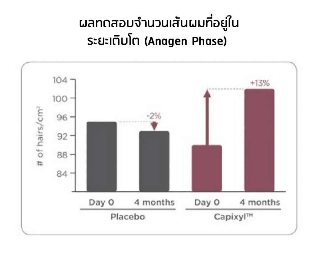 ผลทดสอบทางคลินิก Capixyl Anagen Phase