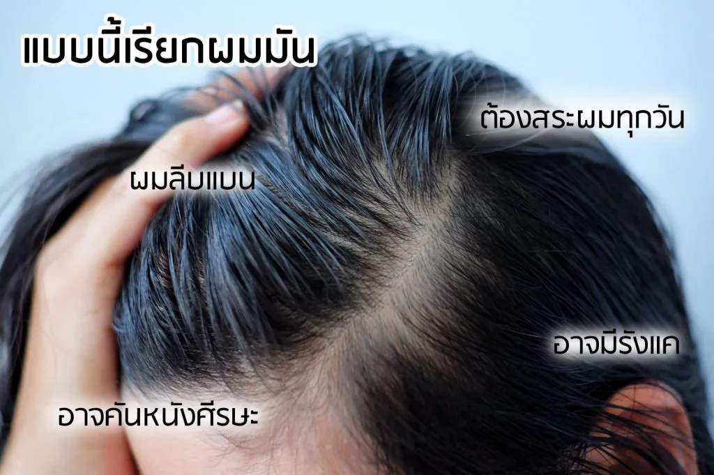 AloEx — characteristics of oily hair