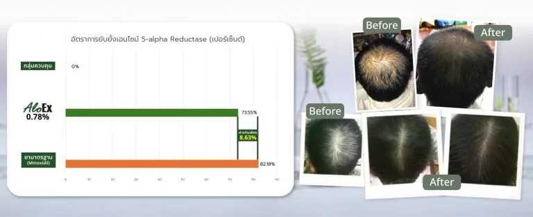 AloEx 与 Finasteride 对比