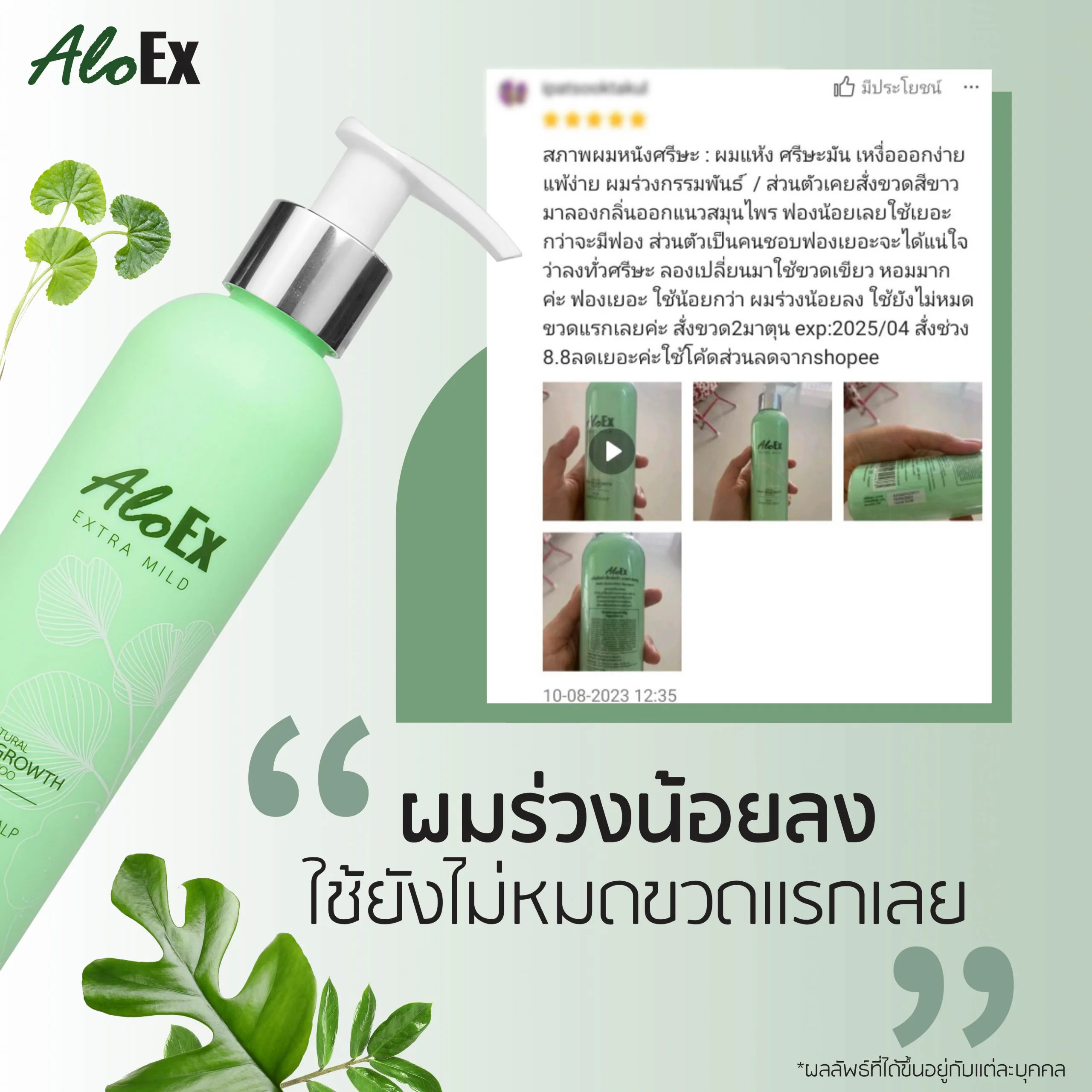 ပထမပုလင်းတောင် မကုန်သေးဘဲ ဆံပင်ကျွတ်တာ လျော့သွားပြီ။