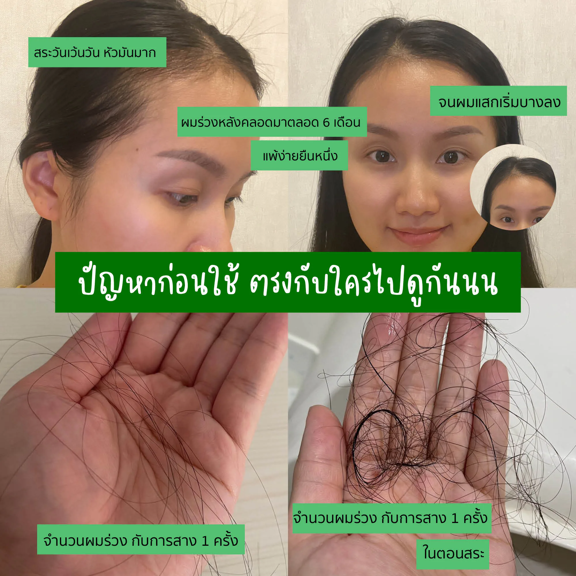 မွေးပြီးခါစမိခင်များနဲ့ အရေပြားအထိအခိုက်မခံသူများအတွက် ဆံပင်ကျွတ်ကာကွယ်ရာမှာ ကူညီပေးတဲ့ ခေါင်းလျှော်ရည်နဲ့ ပြန်လည်ကြိုဆိုပါတယ်: AloEx Extra Mild။