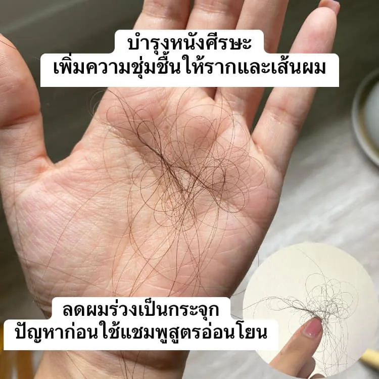 ဒါက အရမ်းကောင်းတဲ့ ထပ်ဖြည့်ပစ္စည်းတစ်ခုပါ â€” ဆံပင်ကျွတ်နဲ့ ဦးရေပြားအမှေး နှစ်ခုလုံးကို တစ်ပြိုင်နက် ထိရောက်စွာလျှော့ချပေးတယ်။