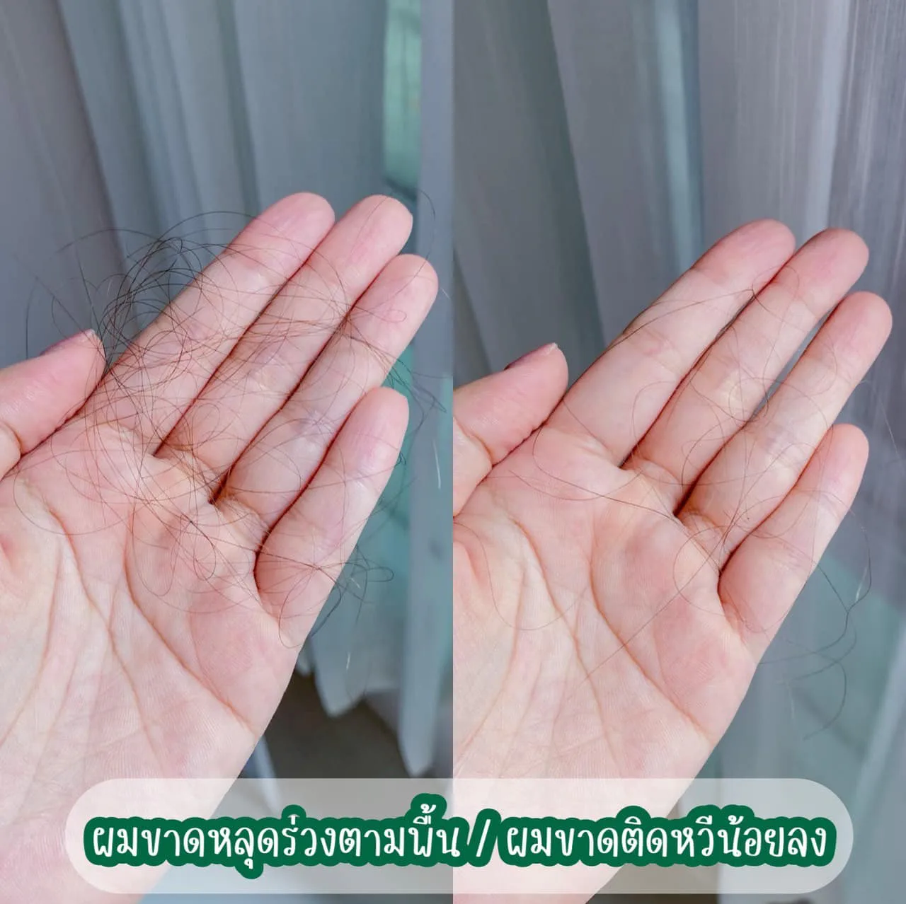 ဆံပင်ကျွတ်မှုကို တကယ်လျှော့ချပေးတဲ့ ခေါင်းလျှော်ရည်ကို အခုပြောင်းသုံးနေပြီ â€” AloEx