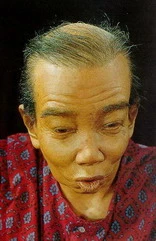 ချဒိုတီပလန် (ထိုင်းရိုးရာ ဆေးဖက်ဝင်အမည်)