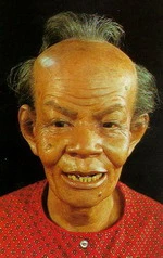 ရဲန်ကရာပူးပိစ် (ထိုင်းရိုးရာ ဆေးဖက်ဝင်အမည်)