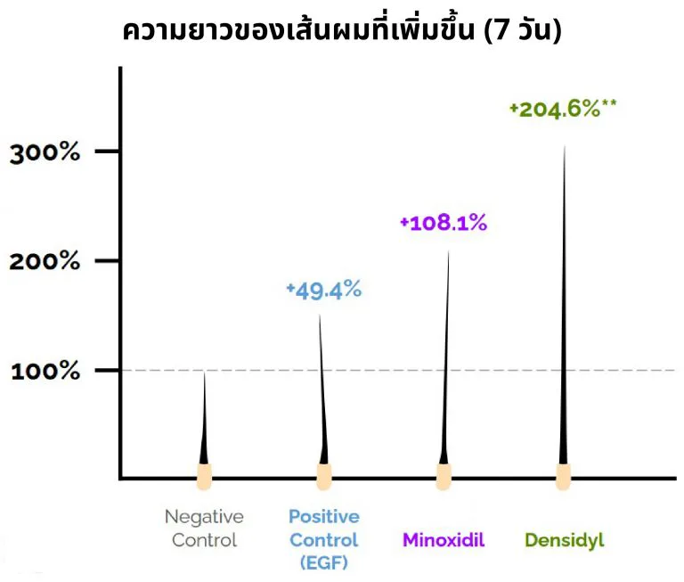 Densidyl ၏ ဆံပင်အရှည် ဂရပ်