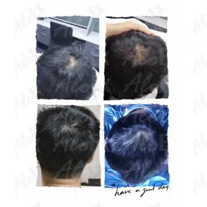 AloEx ထုတ်ကုန် သုံးမီ - သုံးပြီး သုံးသပ်ချက်