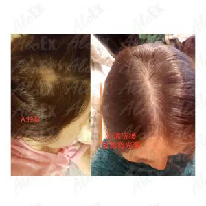 AloEx ထုတ်ကုန် သုံးမီ - သုံးပြီး သုံးသပ်ချက်