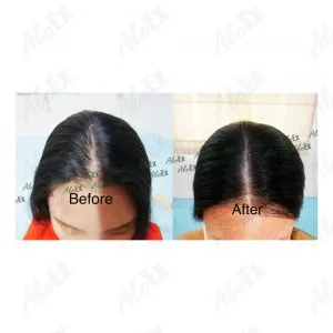 AloEx ထုတ်ကုန် သုံးမီ - သုံးပြီး သုံးသပ်ချက်