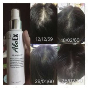 AloEx ဆီရမ် မသုံးမီ-သုံးပြီး သုံးသပ်ချက်