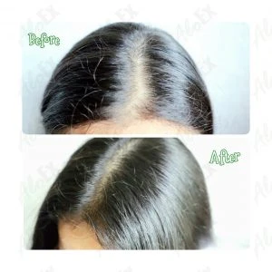 Before & After Reviews — AloEx Products