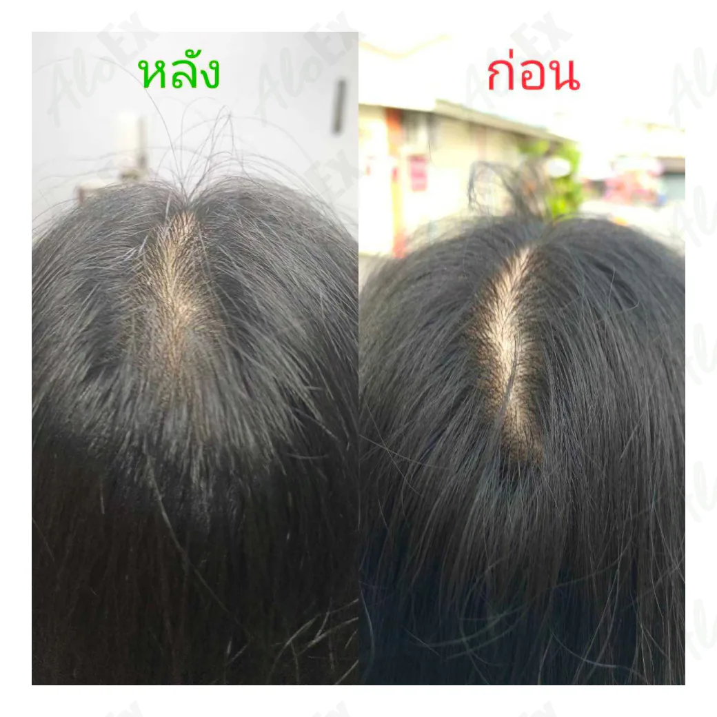 รีวิวก่อนใช้-หลังใช้ ผลิตภัณฑ์ AloEx