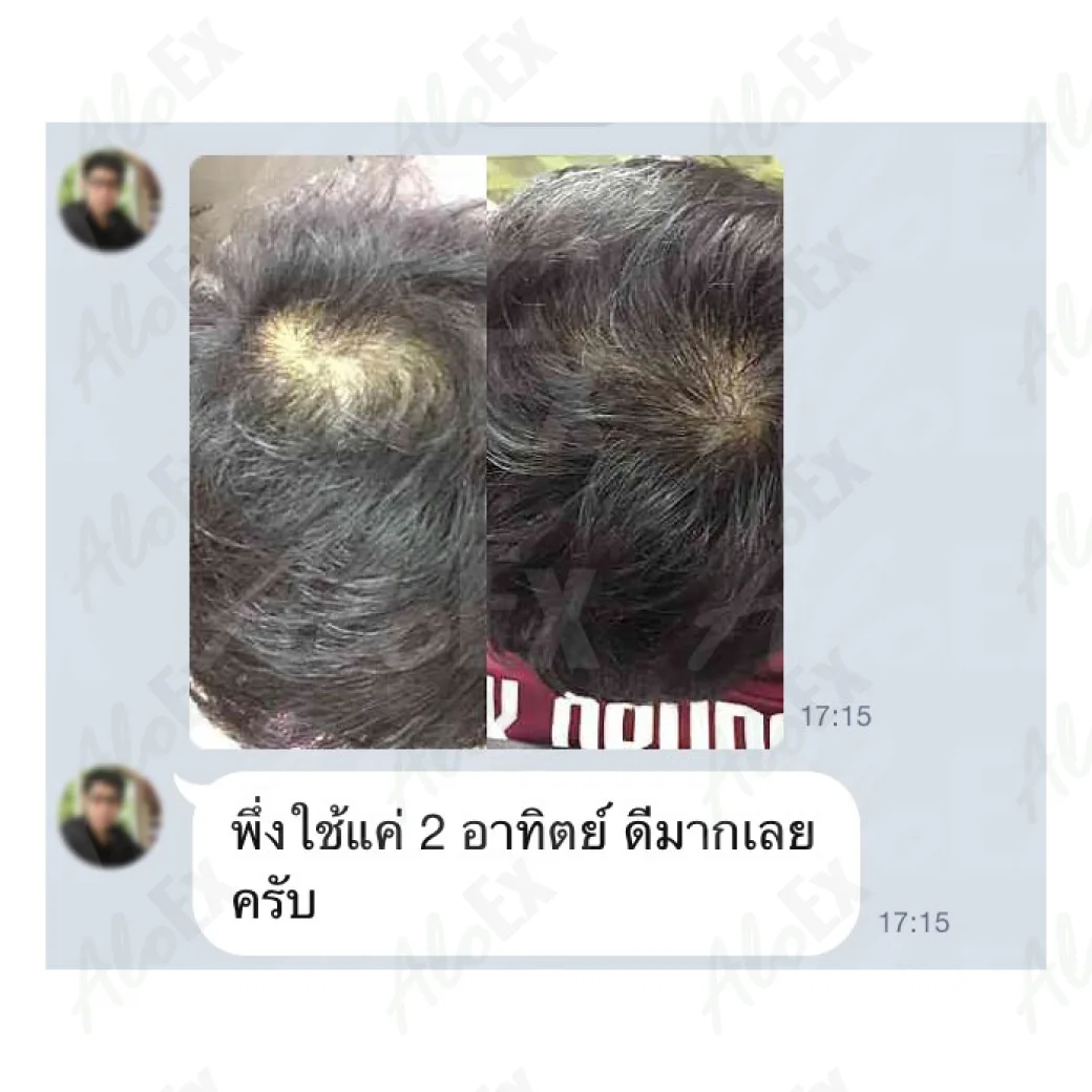 รีวิวก่อนใช้-หลังใช้ ผลิตภัณฑ์ AloEx