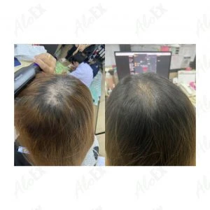 Before & After Reviews — AloEx Products