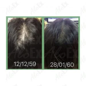 Before & After Reviews — AloEx Products