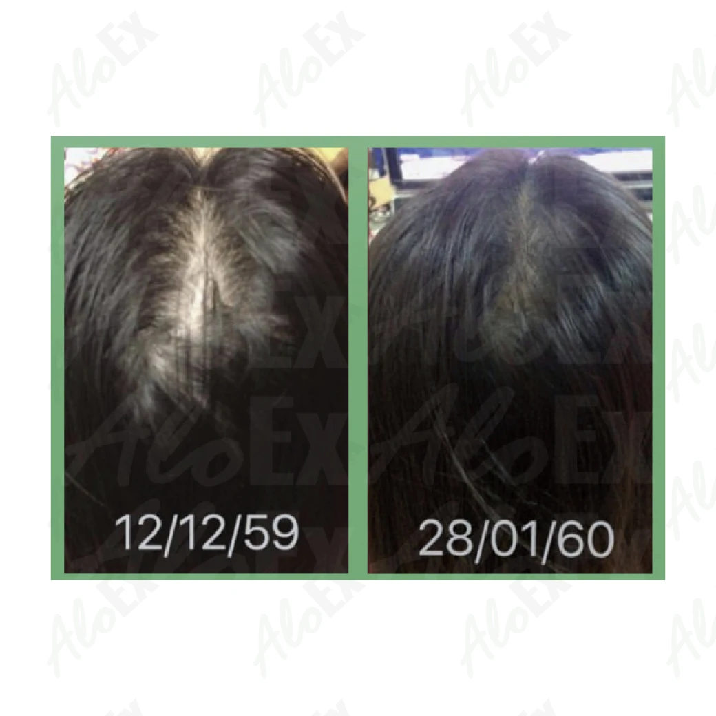 รีวิวก่อนใช้-หลังใช้ ผลิตภัณฑ์ AloEx