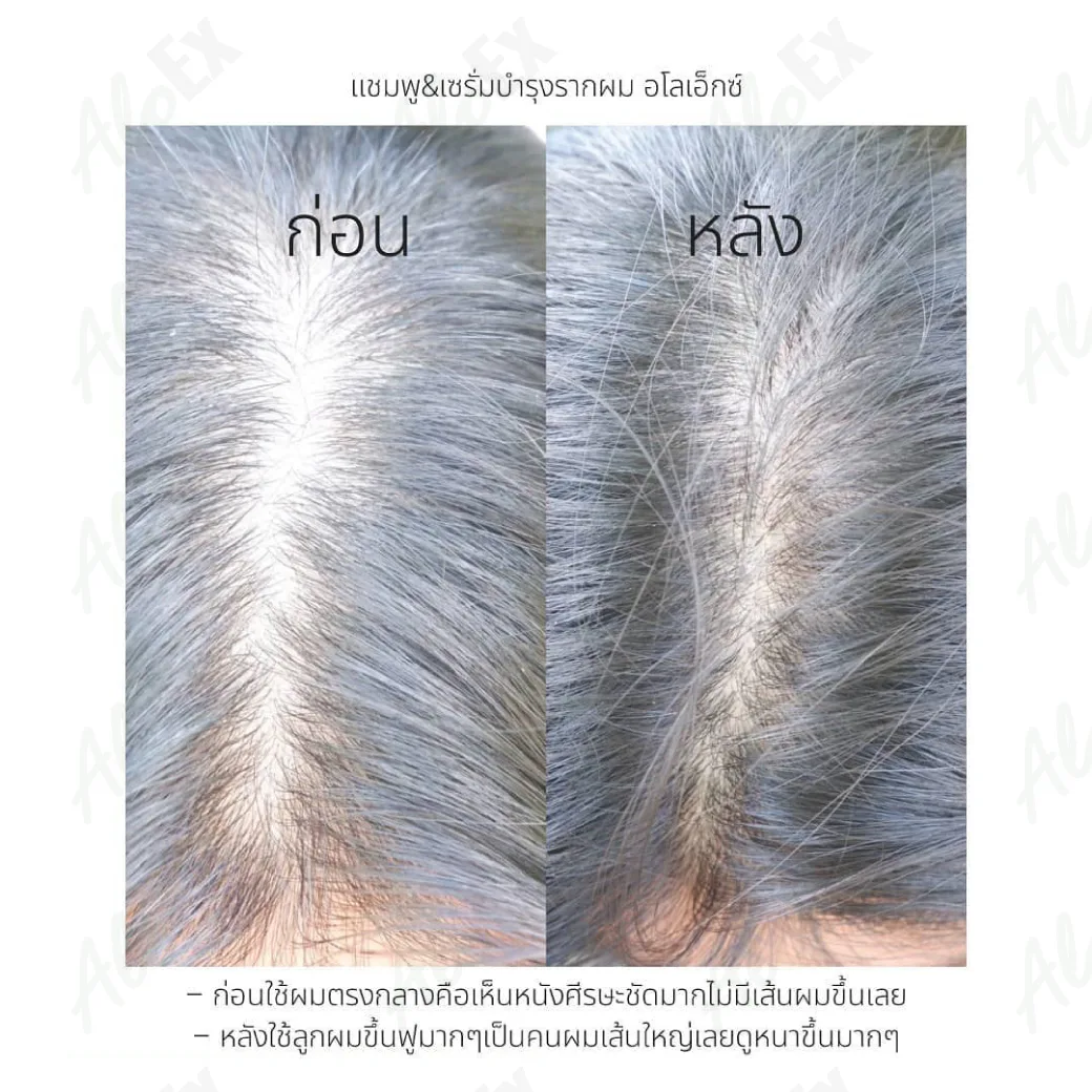 รีวิวก่อนใช้-หลังใช้ ผลิตภัณฑ์ AloEx