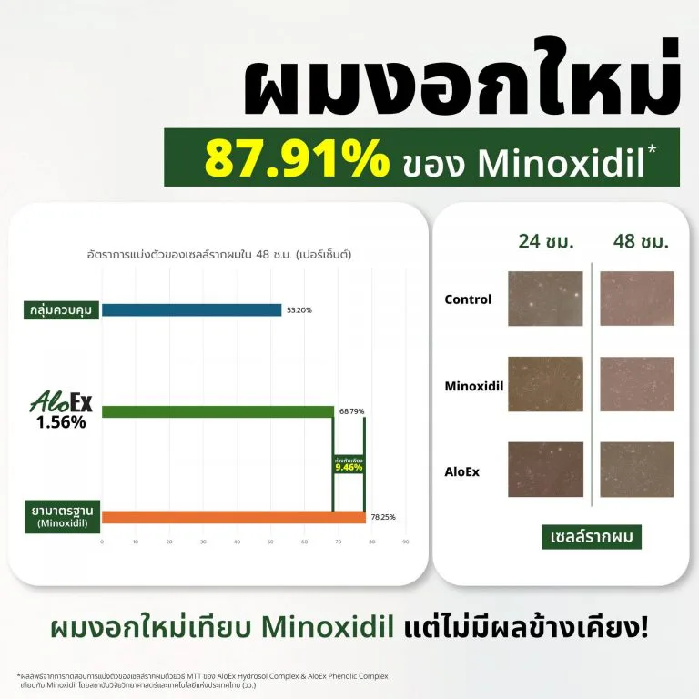AloEx 与 Minoxidil 对比