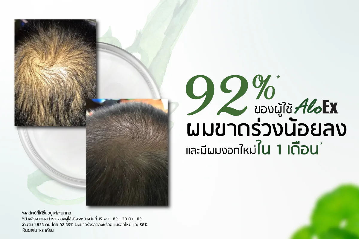 89% of AloEx users saw reduced hair fall and/or new growth
