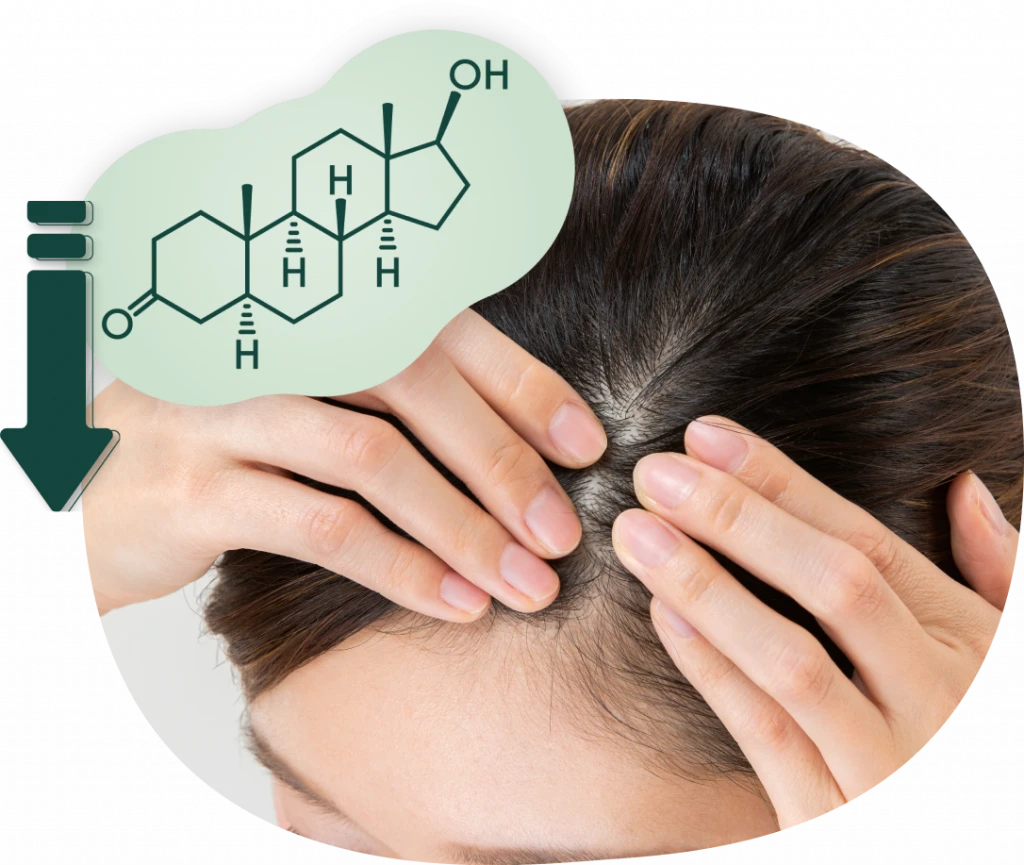 วงจรการเกิด DHT จาก Testosterone ผ่านเอนไซม์ 5α-reductase