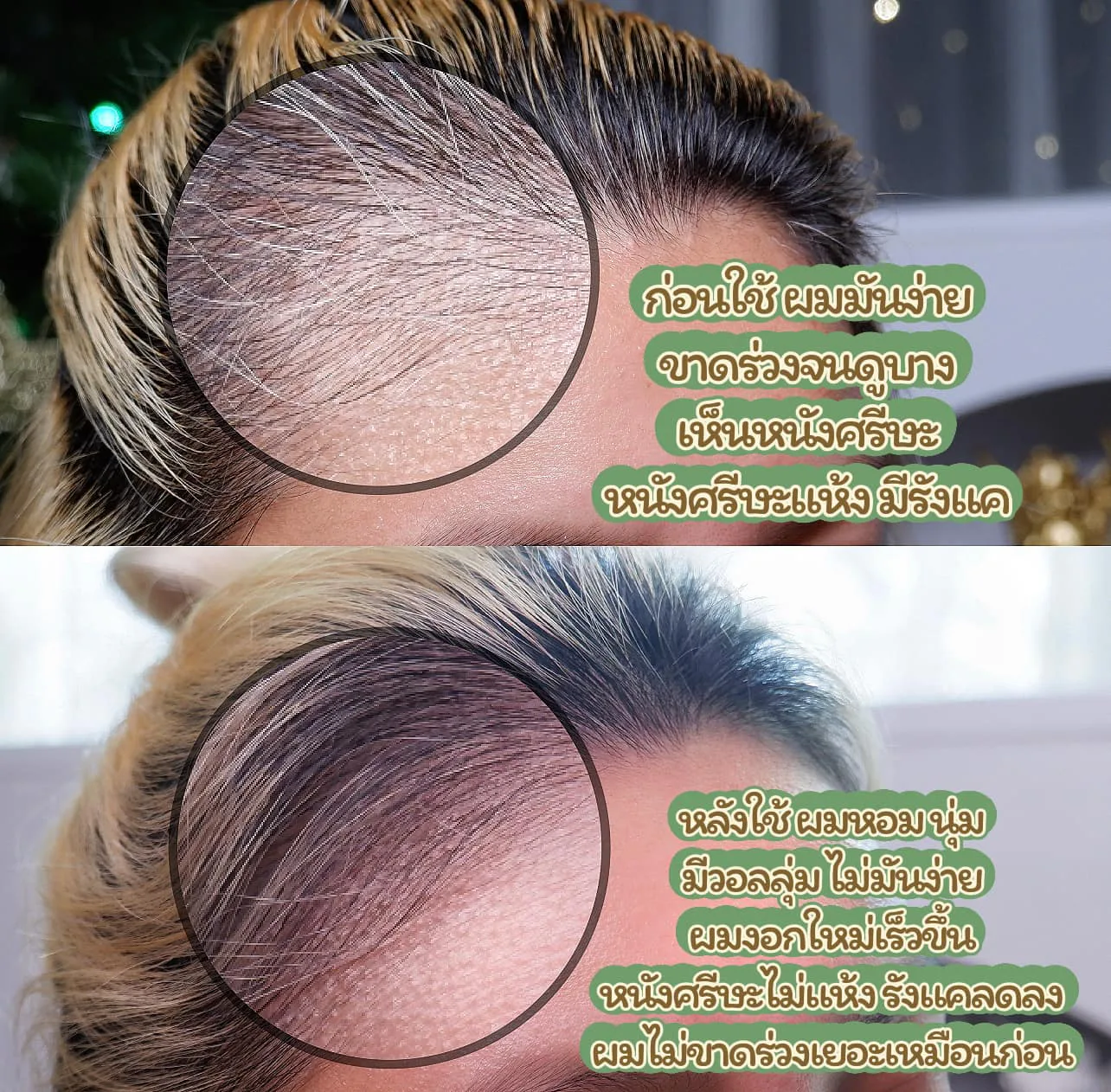 AloEx Extra Mild Natural Hair Regrowth Shampoo က အရေပြားနုနဲ့ဖျက် လွယ်သူ၊ အထူးသဖြင့် ယားယံ ထိခိုက်လွယ်တဲ့ အရေပြားရှိသူတွေအတွက် ဖော်မြူလာဖြစ်တယ်။