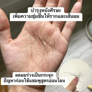 အရမ်းကောင်းတဲ့ ဖော်မြူလာအသစ်တစ်ခုလို့ ဆိုရမယ်၊ သုံးတဲ့အခါ ဆံပင်ကျွတ်တာရော ဂွမ်းပိုးကိုပါ တစ်ပြိုင်နက်တည်း လျှော့ချပေးတယ်။