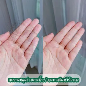 အခုတော့ ဆံပင်ကျွတ်၊ ဆံပင်ပြတ်ခြင်းကို တကယ်တမ်း လျှော့ချပေးတဲ့ AloEx ရဲ့ ခေါင်းလျှော်ရည်ကို ပြောင်းသုံးဖြစ်သွားပြီ။