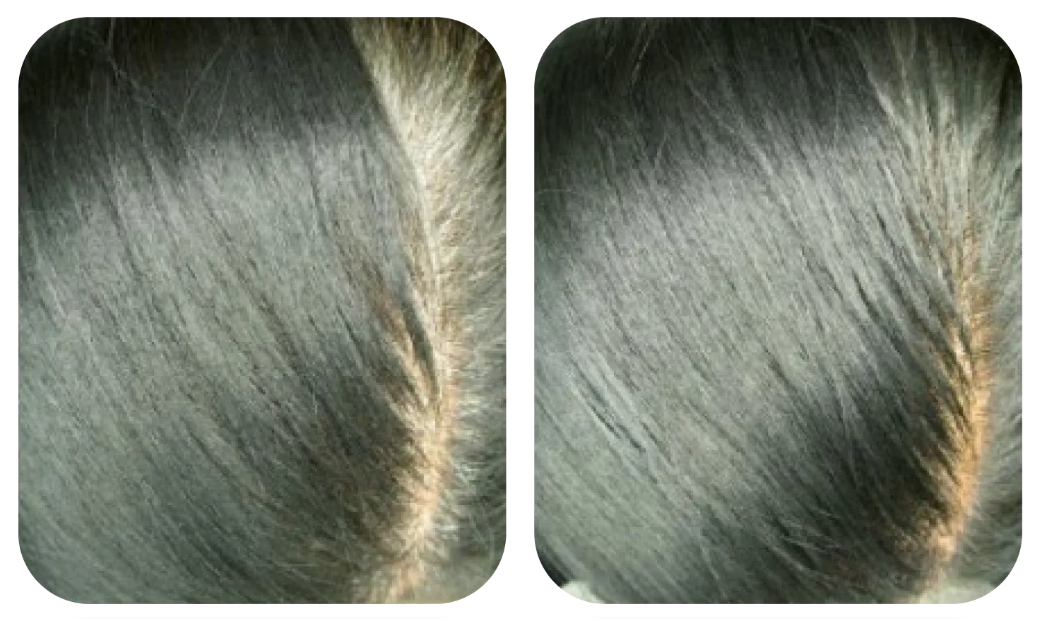เปรียบเทียบหนังศีรษะก่อนและหลังใช้ AloEx Organic Intensive Hair Serum ภาพที่ 2