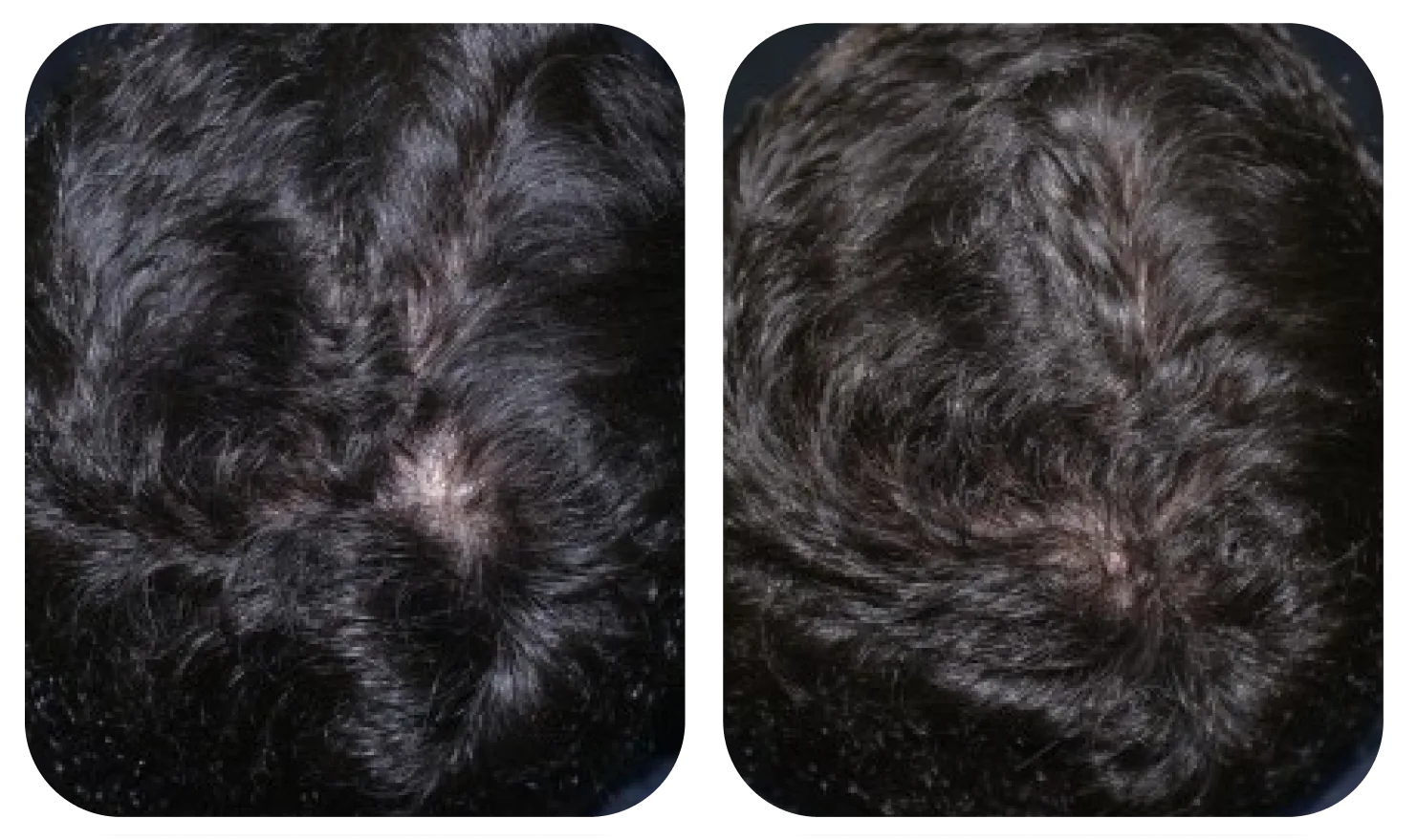 เปรียบเทียบหนังศีรษะก่อนและหลังใช้ AloEx Organic Intensive Hair Serum ภาพที่ 3