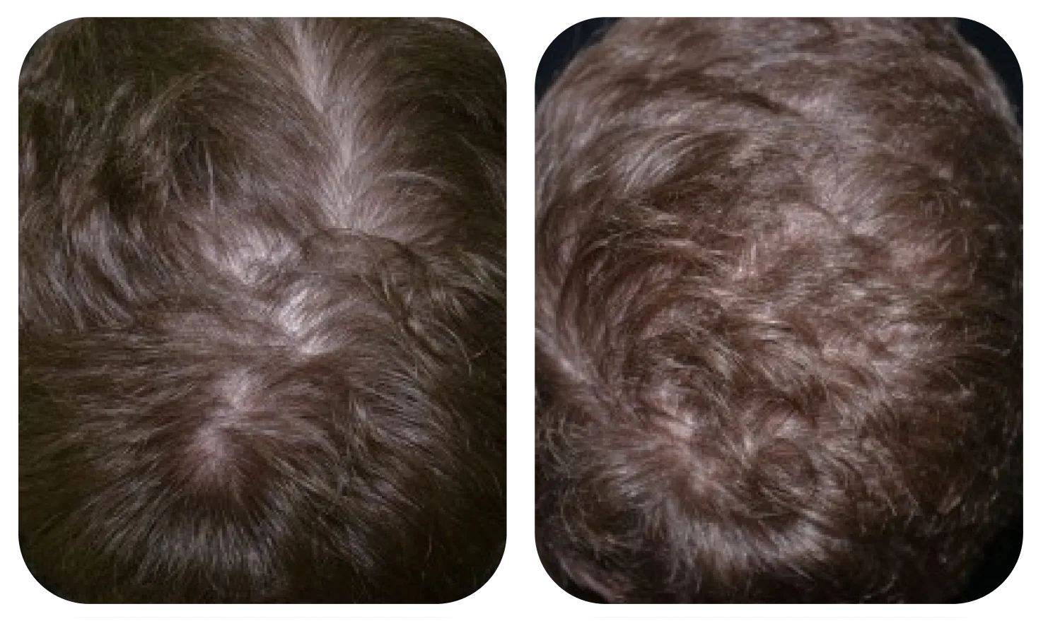 เปรียบเทียบหนังศีรษะก่อนและหลังใช้ AloEx Organic Intensive Hair Serum ภาพที่ 4
