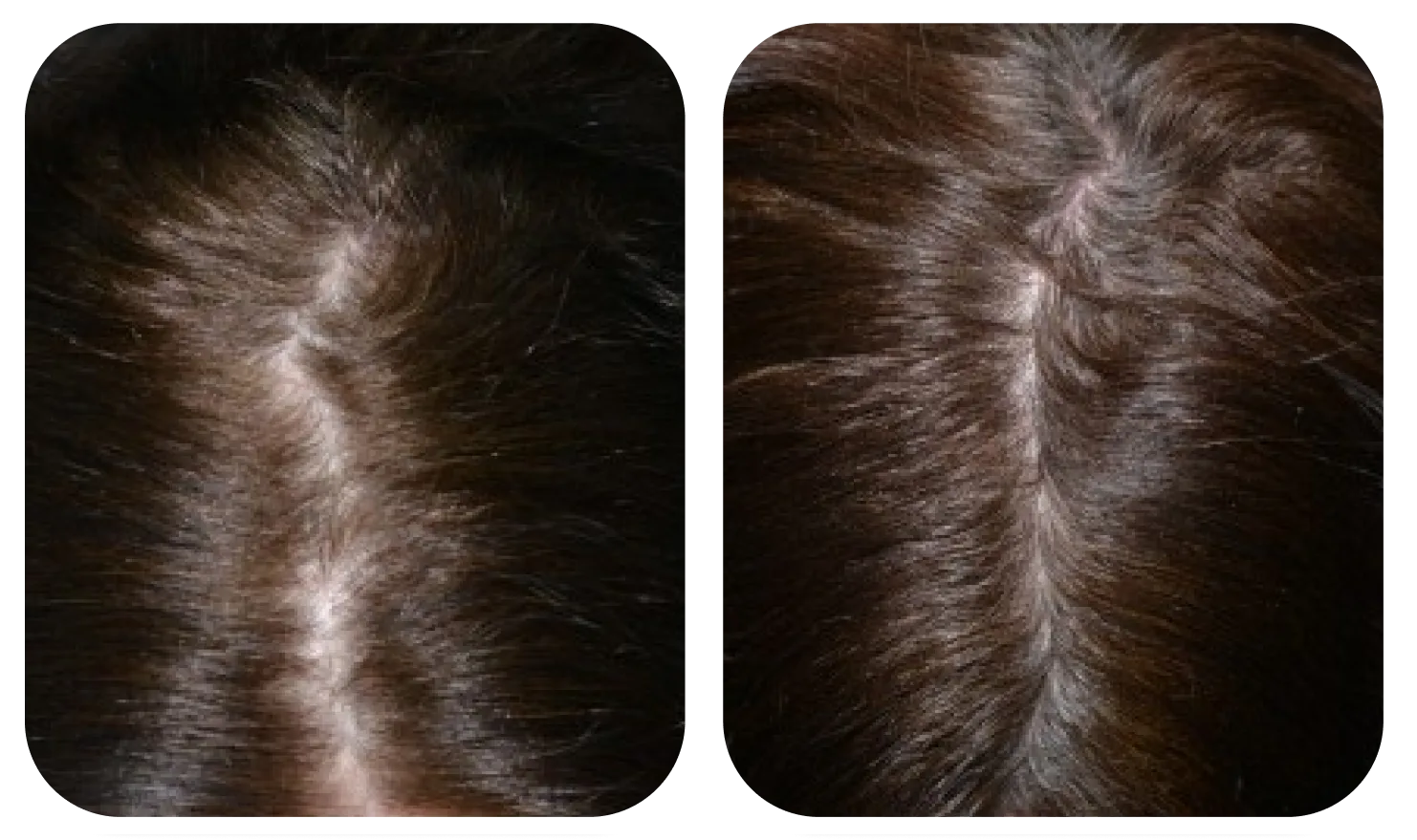 เปรียบเทียบหนังศีรษะก่อนและหลังใช้ AloEx Organic Intensive Hair Serum ภาพที่ 5