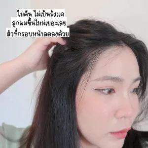 ဦးရေပြားမှာ seborrheic dermatitis ဖြစ်တတ်သူတိုင်း အရမ်းယားတယ်ဆိုတာ သိကြမှာပါ၊ ဆံပင်ကျွတ်ခြင်းလျှော့ချတာ နာမည်ကြီးတဲ့ AloEx အမှတ်တံဆိပ်ရဲ့ ဒီ AloEx Extra Mild ကို တွေ့သွားတဲ့အထိပေါ့။