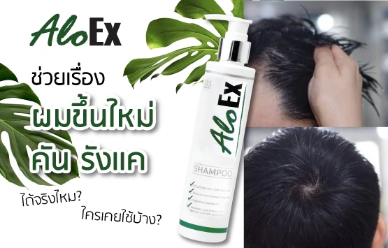 AloEx သည် ဆံပင်အသစ်ပေါက်ခြင်း၊ ယားယံခြင်းနှင့် ပြောင်းဖားဖြစ်ခြင်းကို တကယ်ကူညီပါသလား။ ဘယ်သူတွေ စမ်းသုံးဖူးပြီလဲ။