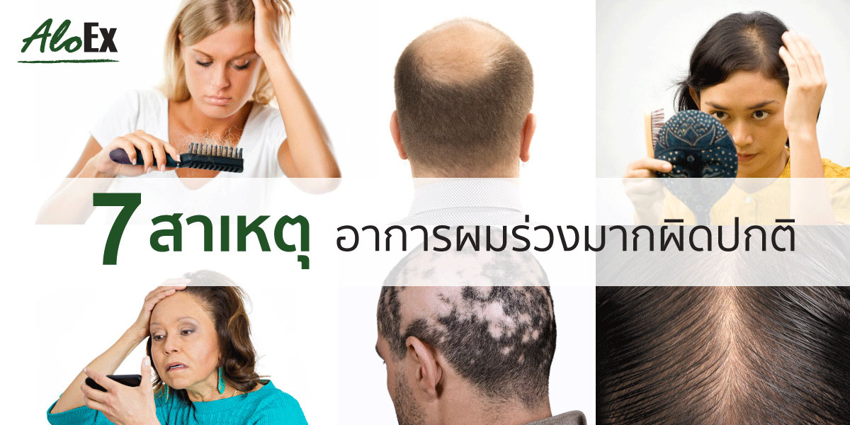 ผมร่วงนี้มีที่มา : 7 สาเหตุอาการผมร่วงมากผิดปกติ - Aloex หยุดผมร่วง ลดผมบาง  สร้างผมใหม่