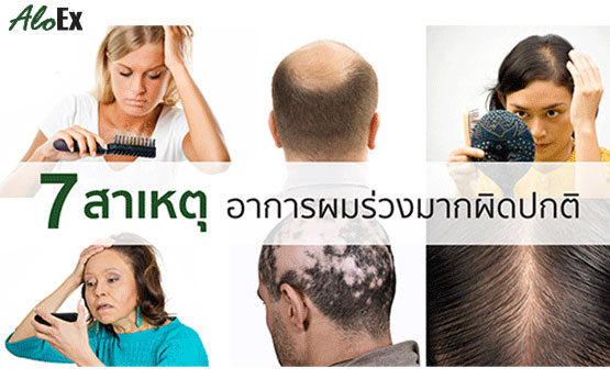 ผมร่วงนี้มีที่มา : 7 สาเหตุอาการผมร่วงมากผิดปกติ - Aloex หยุดผมร่วง ลดผมบาง  สร้างผมใหม่